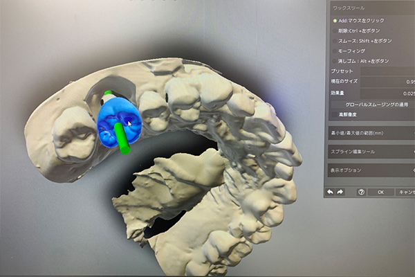 熟練の技工士による、最高品質の技工物〜連携技工所のご紹介〜