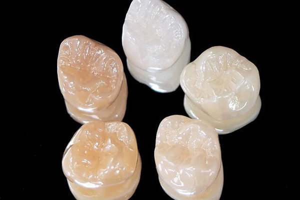 「やってよかった」と思っていただけるワンランク上のセラミック治療